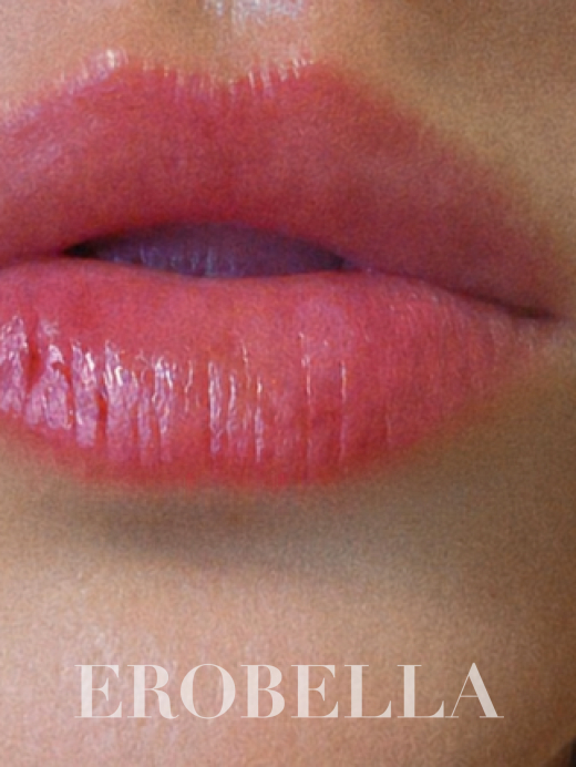 Photo #1