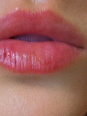 Photo #1