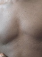 Photo #1